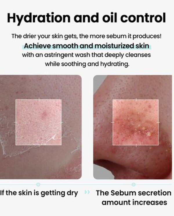 Goodal Super Melting Sebum Cleansing Oil
